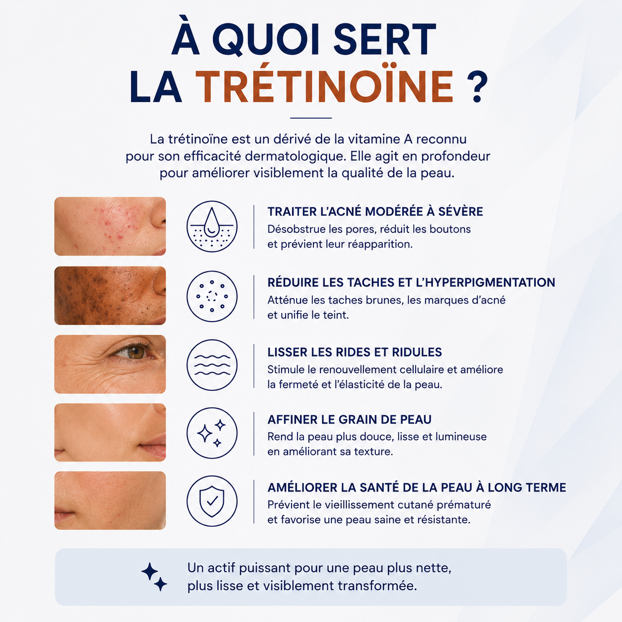 Crème Trétinoïne 0,05%